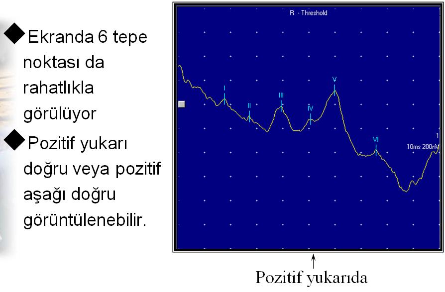 ABR-BERA Cihazı