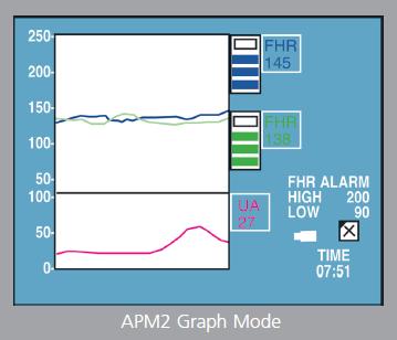 Nicolet VersaLab APM, VersaLab APM2, Fetal Monitor